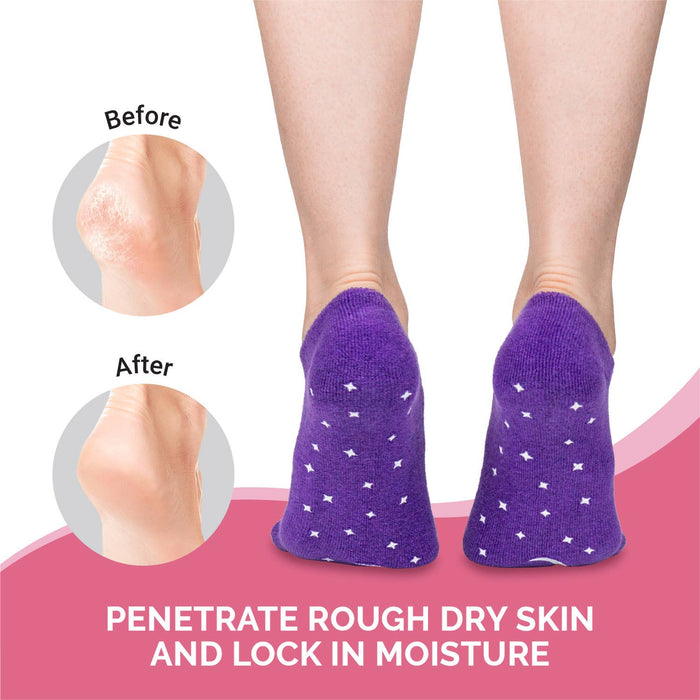 Gel Socks with Essential Oil Infused Gel Lining: Lavender in Purple