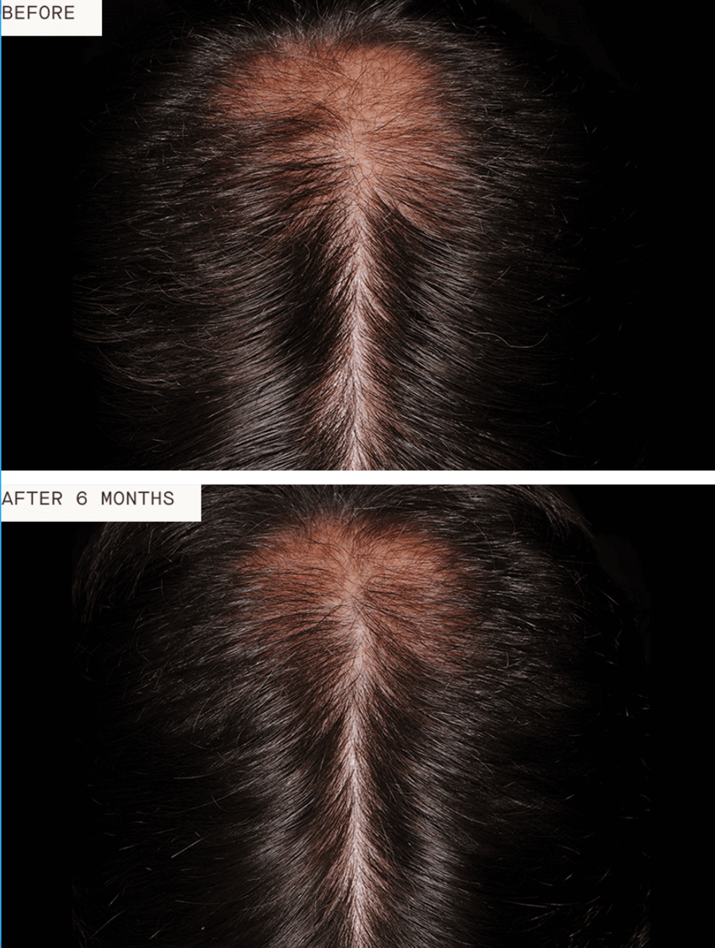 Nutrafol Men - 3 month supply by Glow Med Spa